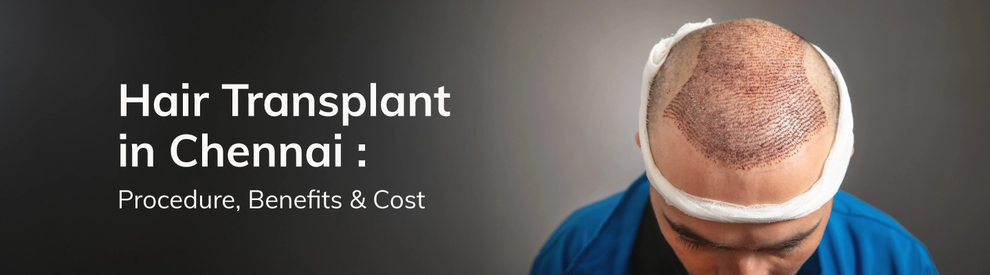 Hair transplant in Chennai

